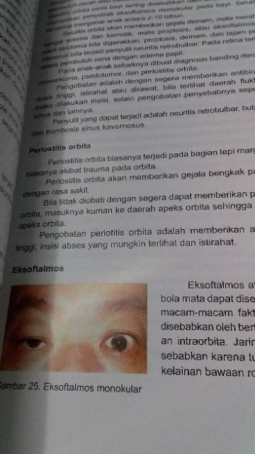 ( ORIGINAL ) BUKU ILMU PENYAKIT MATA EDISI 5 FKUI TH.2019