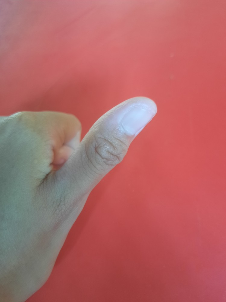 Insektisida Abamektin Absina 36ec Kemasan 100 Ml