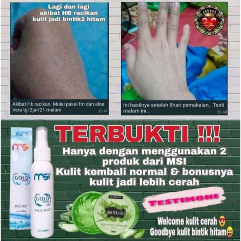 Paket Hemat Msi Face mist + Msi Aloe Vera Gel AloeVera Msi Original