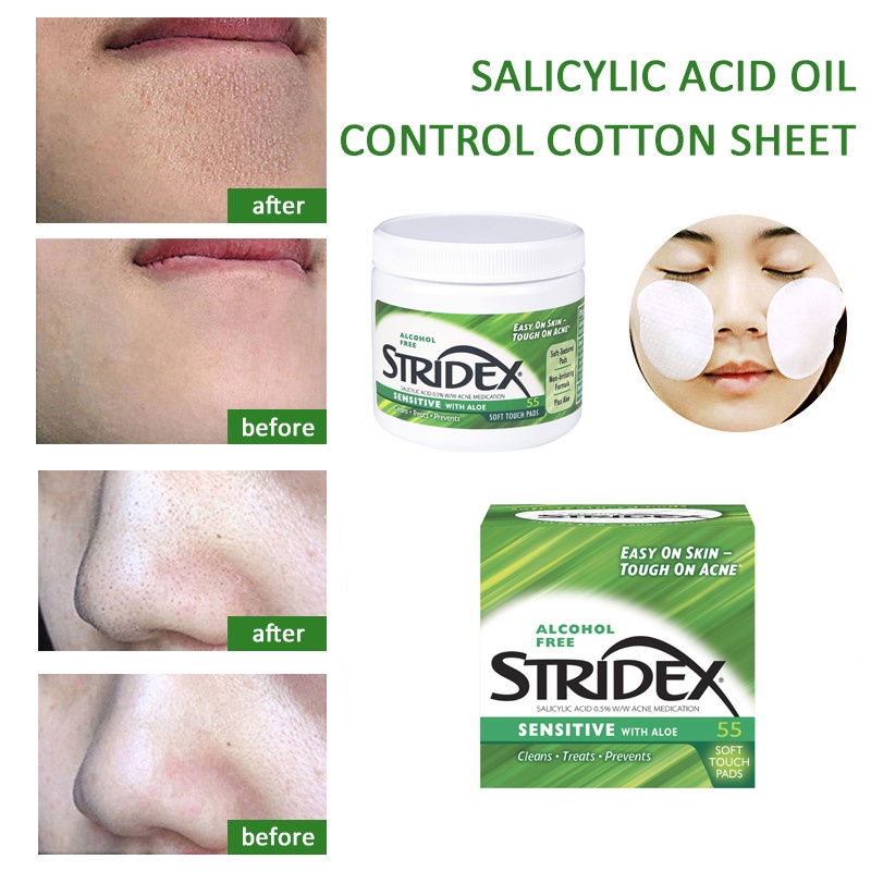 Stridex Salicylic Acid 0.5% With Acne Medication 55 Soft Touch Pads Cegah Jerawat Bebas Alkohol ORI USA