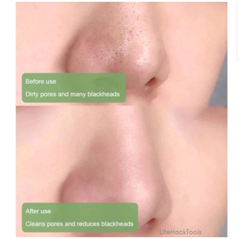 Green Stick Mask Meidian / Masker Wajah Green Tea Pembersih Komedo / Masker Komedo / Meidian Green Tea Mask Cleansing Clay Stick / Masker Menghilangkan Komedo Ampuh / Masker Melembutkan Kulit / Masker Mengangkat Sel Kulit Mati / Masker Mengurangi Minyak