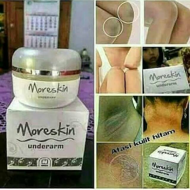 Moreskin underarm