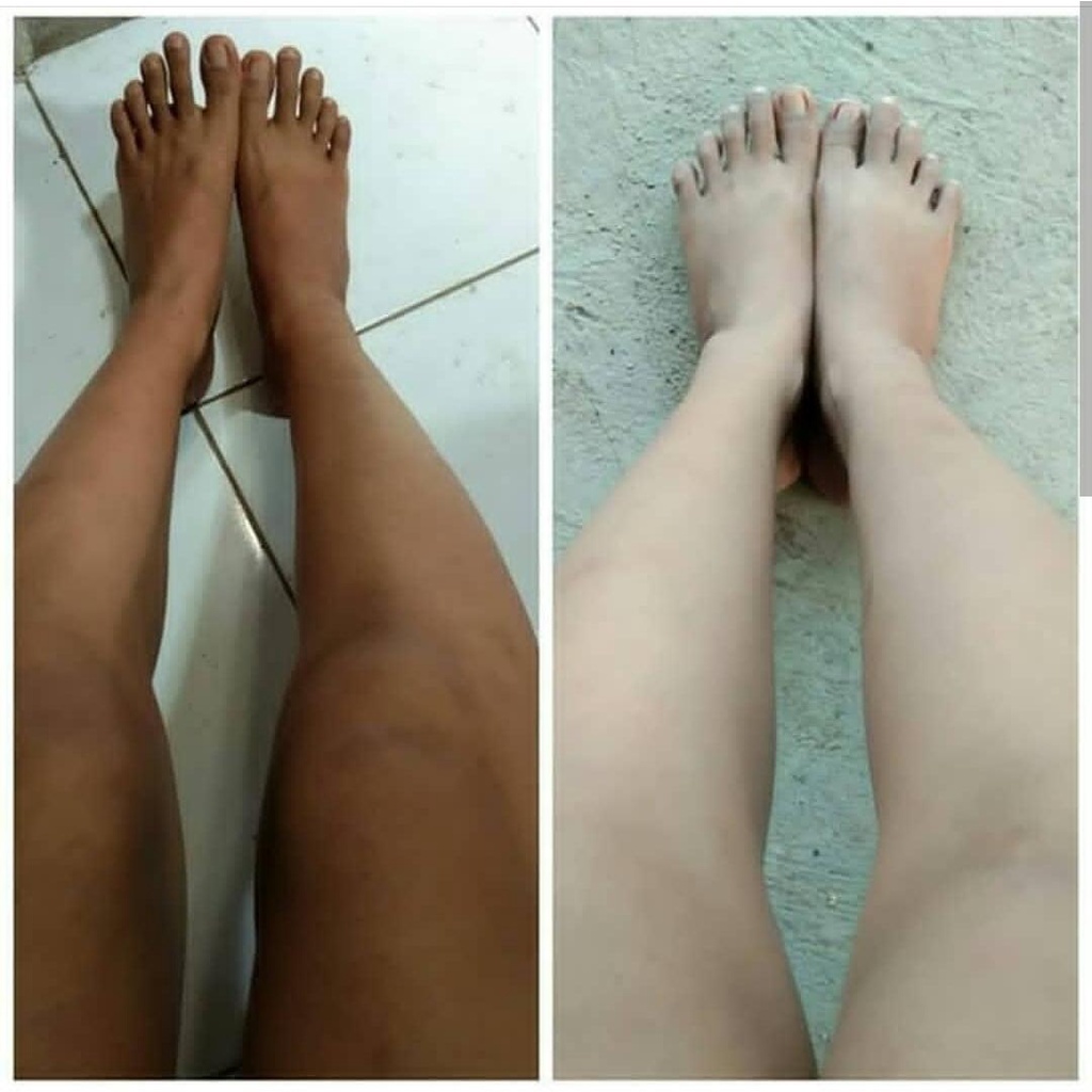 LOTION PEMUTIH KROMOSOM / LOTION DOKTER YANG AMPUH MEMUTIHKAN KULIT SUSAH PUTIH