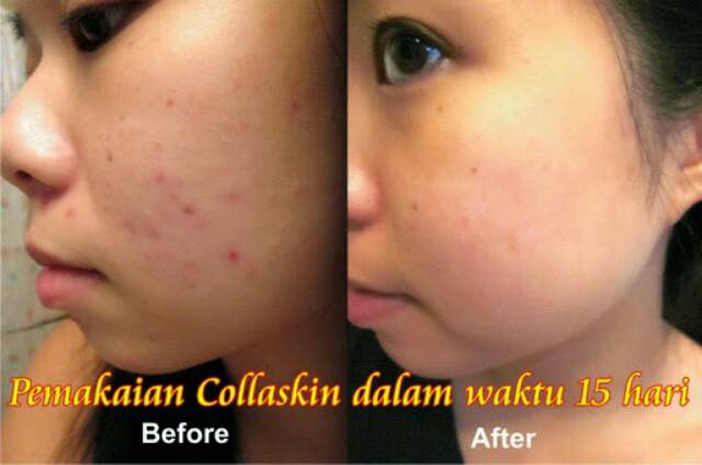 PAKET COLLASKIN PERAWATAN TUBUH ALAMI