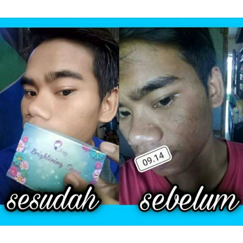 Sabun Kedas Beauty Original, Kedas  Beauty ORI, Sabun  Kedas Beauty BPOM ,Perawatan, Kecantikan,Keda