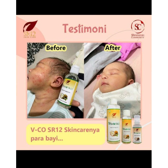 

VCO/VIRGIN COCONUT OIL/MINYAK KELAPA MURNI