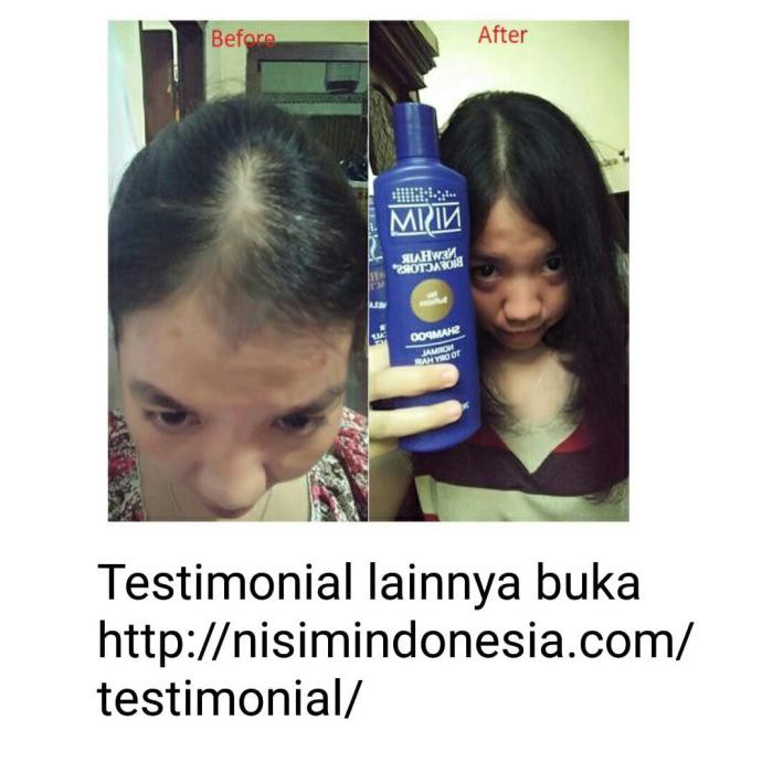 HAIR TONIC NISIM BIOFACTOR NORMAL MINYAK