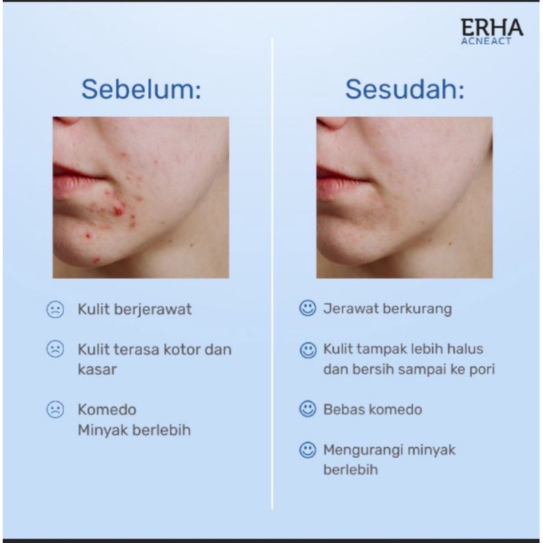 ERHA Acne Cleanser Scrub Beta Plus (ACSBP) 60g