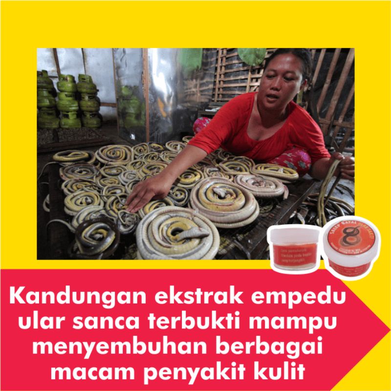 Salep Obat Kurap Kudis Paling Ampuh Gatal Kulit Gatel Kadas Eksim Kering Kutu Air Jamur Selangkangan-6