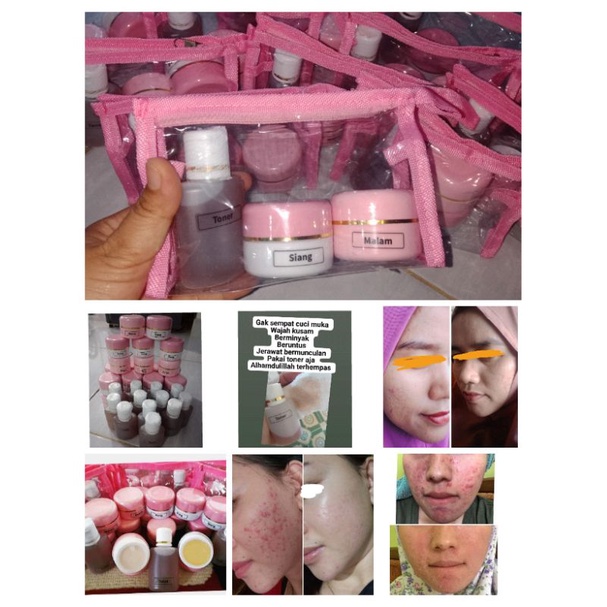 CR GLOW  paket lengkap cream siang, cream malam dan toner