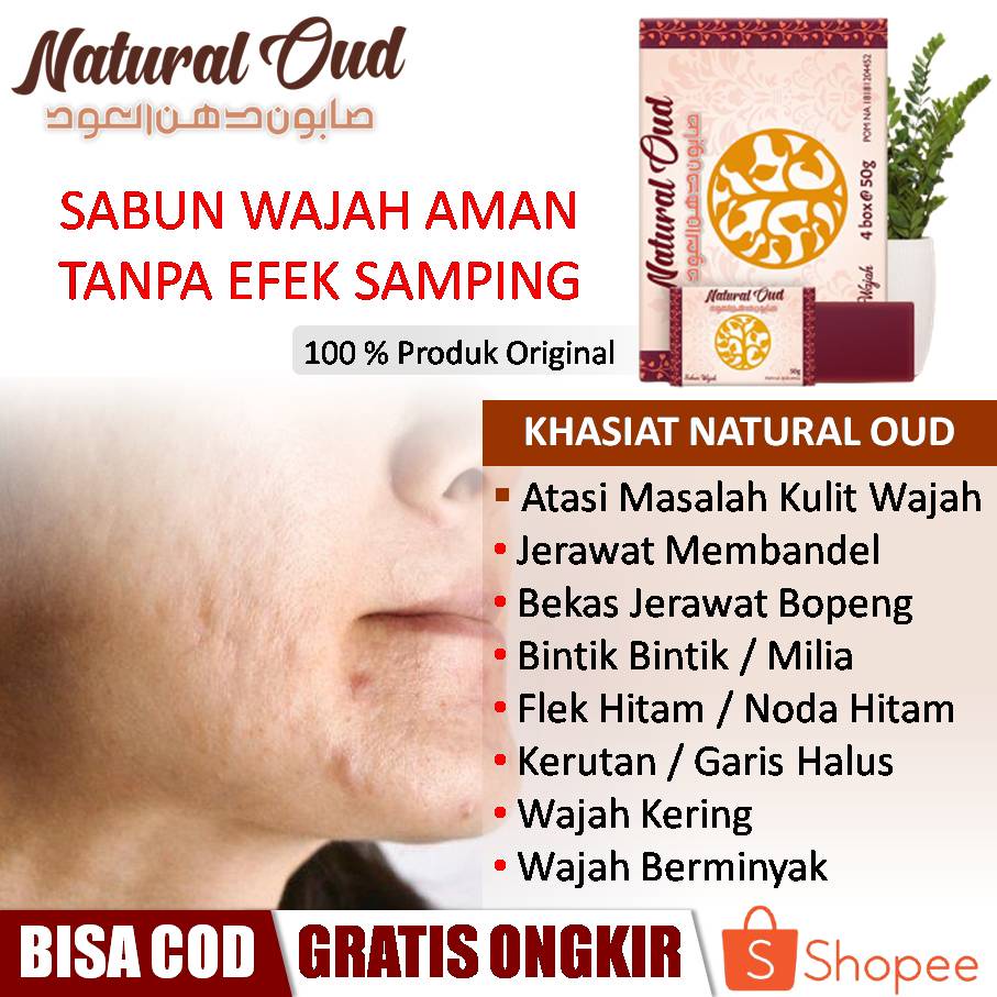 Jual Natural Oud - Sabun Cuci Muka Pria Dan Wanita, Atasi Jerawat