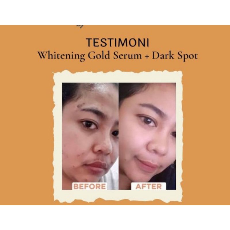 Dark Spot Treatment Serum II Khusus Flek MS GLOW