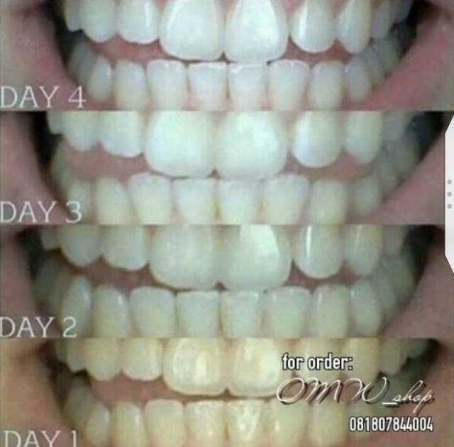 Ready Whitening Teeth Natural Pemutih Gigi Alami