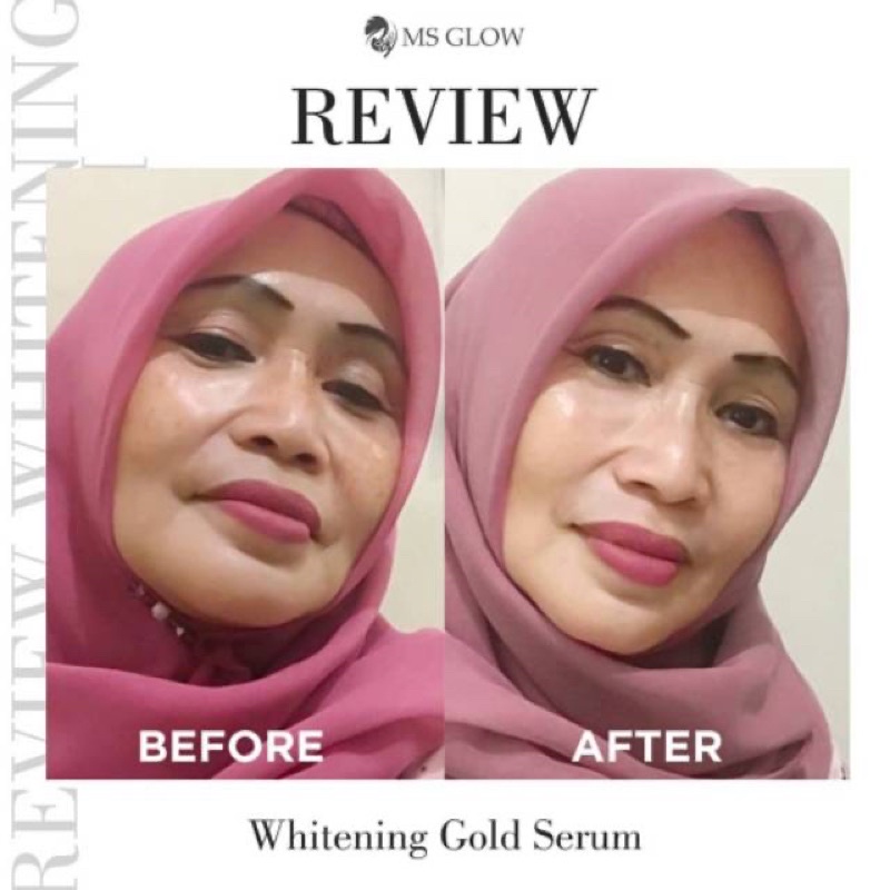 MS GLOW SERUM GOLD / WHITENING GOLD SERUM MS GLOW