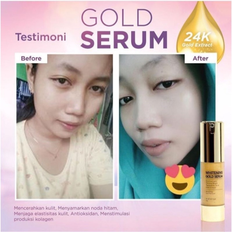 MS GLOW SERUM GOLD / WHITENING GOLD SERUM MS GLOW