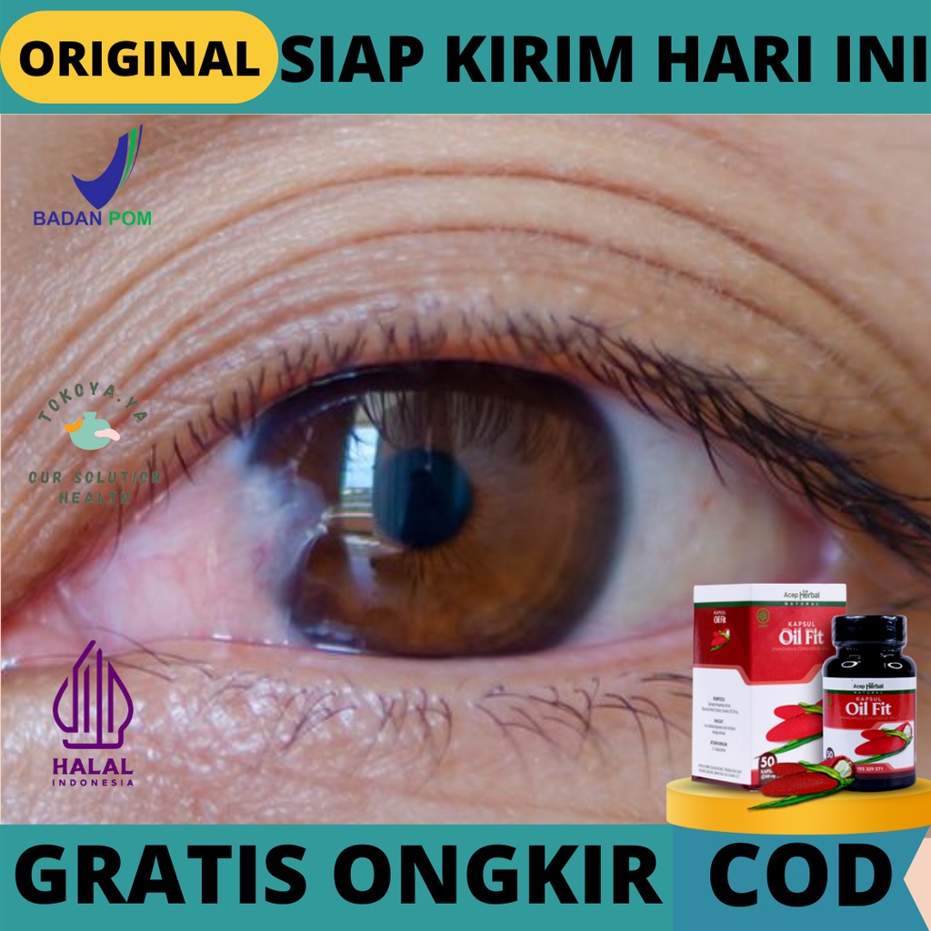 OIL FIT ACEP HERBAL 100% ORIGINAL BPOM, Obat Ulkus Kornea, Luka Pada Mata, Obat Penghilang Mata Tera