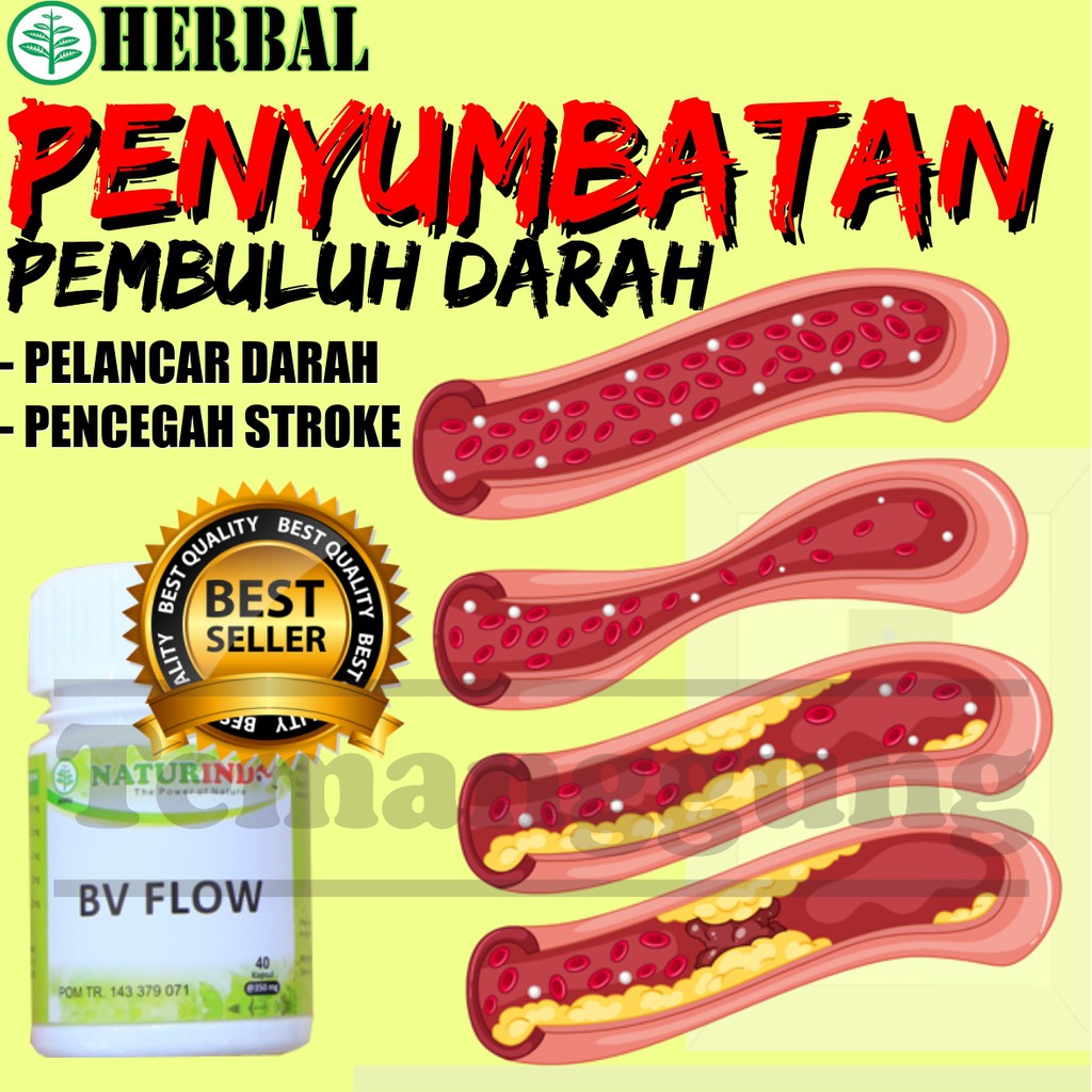 

OBAT HERBAL PENYUMBATAN PEMBULUH DARAH PELANCARKAN PELANCAR PEREDARAN DARAH MENGGUMPAL HERBAL AMPUH