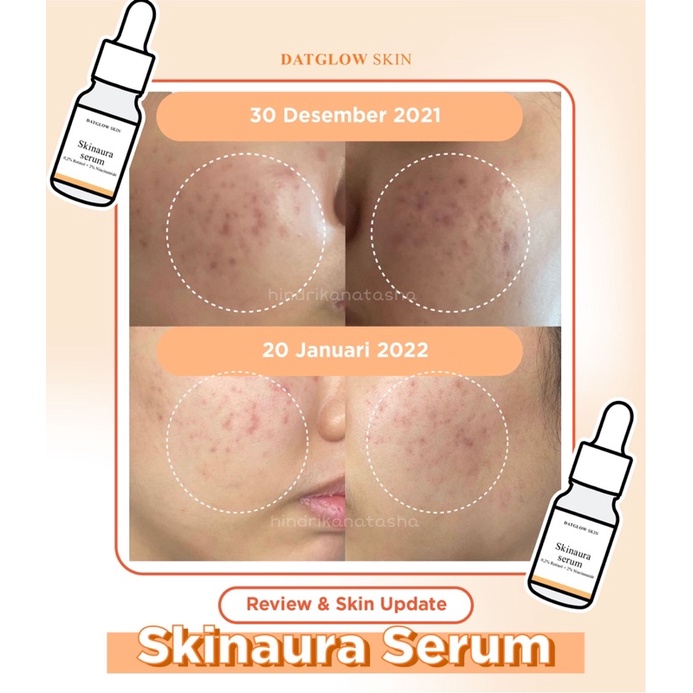 ✨Up Your Look✨ Skinaura serum niacinamide retinol Datglowskin datglow skin