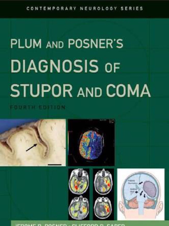 

Buku Kedokteran Plum and Posner Diagnosis of Stupor and Coma