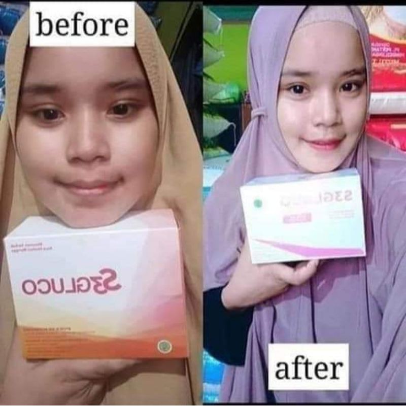 

s3gluco susu pemutih