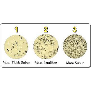 ovutest Scope Alat Uji Masa Subur (B49001) - scope ovutest