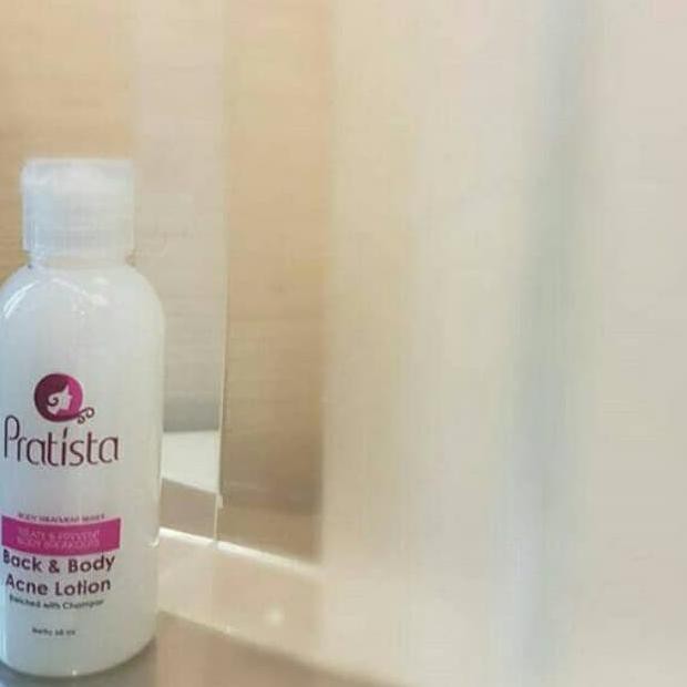 acne lotion terbaik