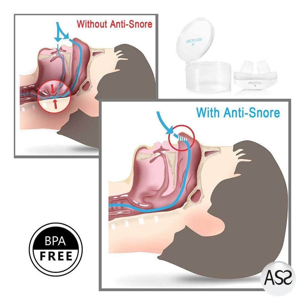 ASS Shop - Samifun Anti Ngorok Pernafasan Hidung Stop Snoring Solution - MX-555