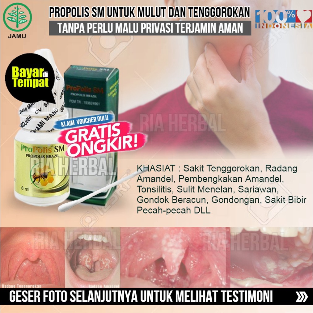 Jual [ Bertestimoni ] 5x Lebih Original Propolis Sm Obat Amandel