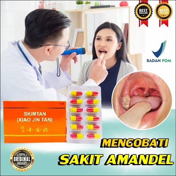 TERBARU xiao jin tan obat herbal cina obat untuk menghilangkan amandel untuk anak dan dewasa asli or