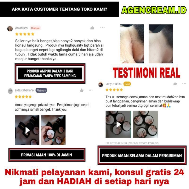 CREAM LEHER SHCOSMETIC ORIGINAL PENCERAH LIPATAN TUBUH AMPUH