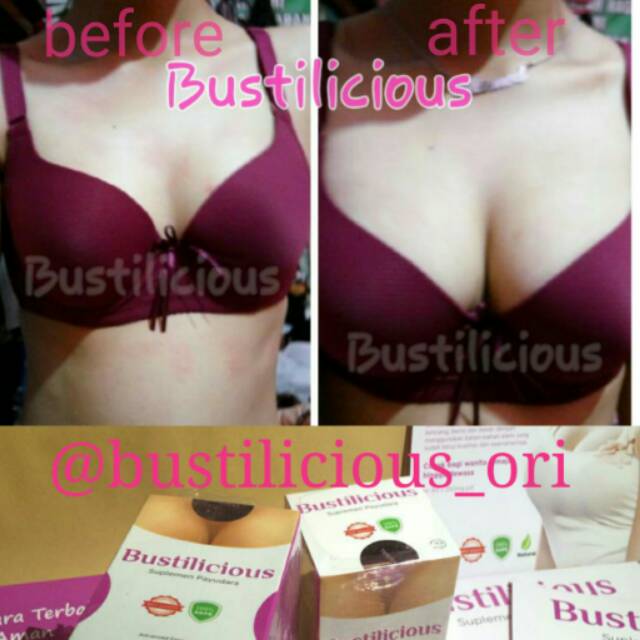 BUSTILICIOUS suplemen pembesar payudara terbaik