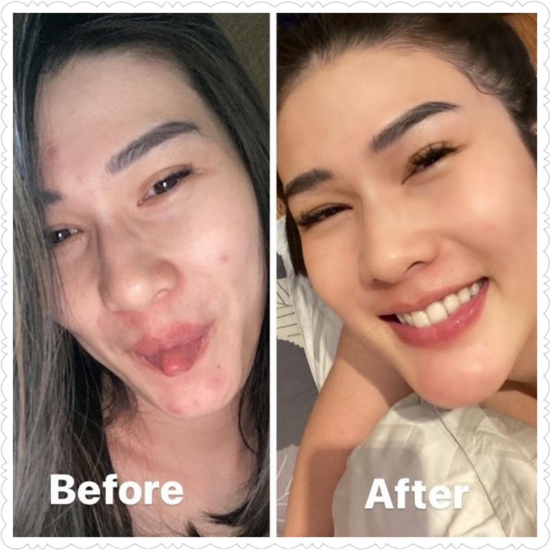 STEV Skincare by STEVIE AGNECIA Paket Glowing Kecantikan Memutihkan BPOM HALAL AMAN ORIGINAL