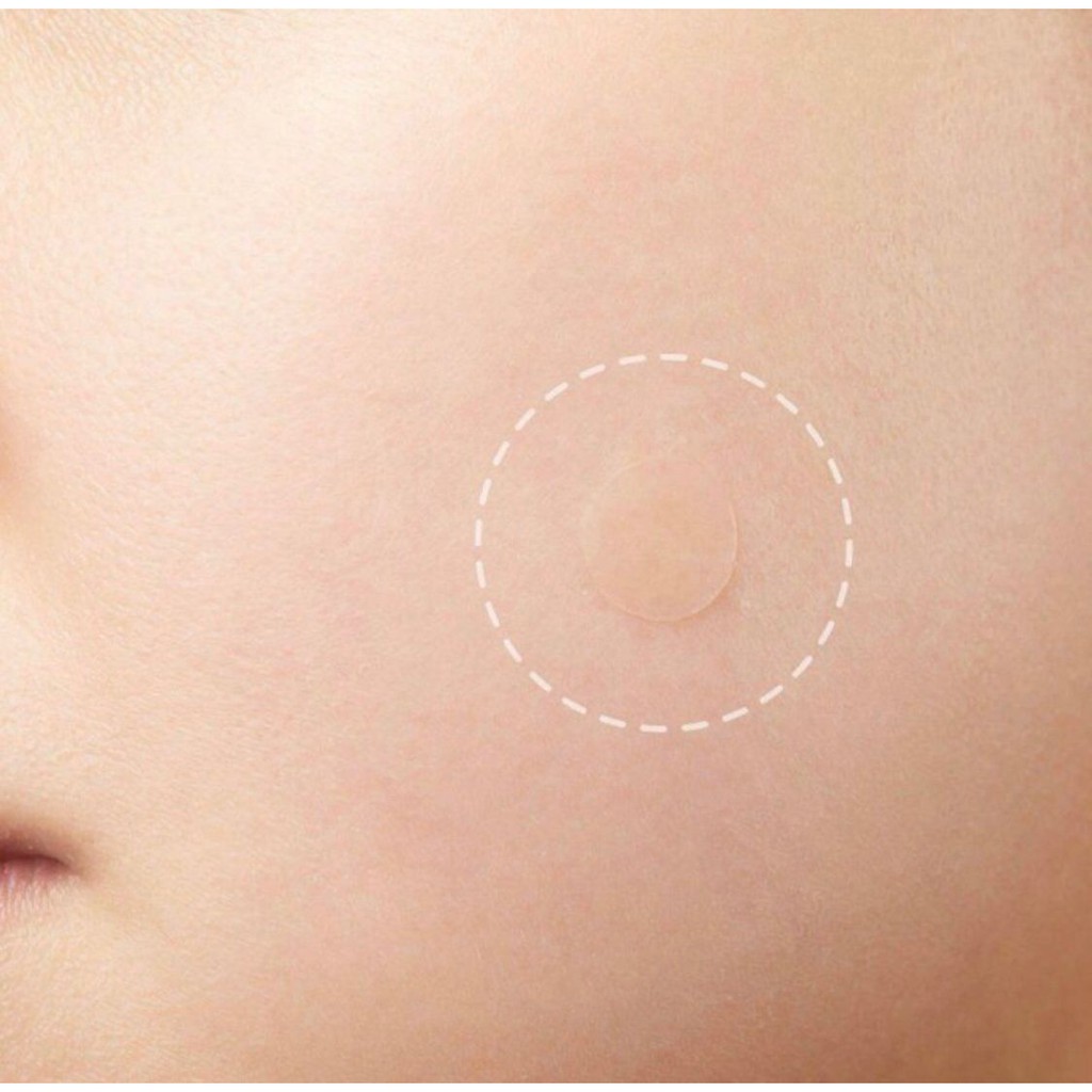 Sticker Jerawat Sticker Pembersih Jerawat Acne Patch Pimple Blemish Removal Stickers Breathable Pimple Blemish Removal Sticker Facial Care 24 patches Acne Pimple Patch Hydrocolloid Invisible