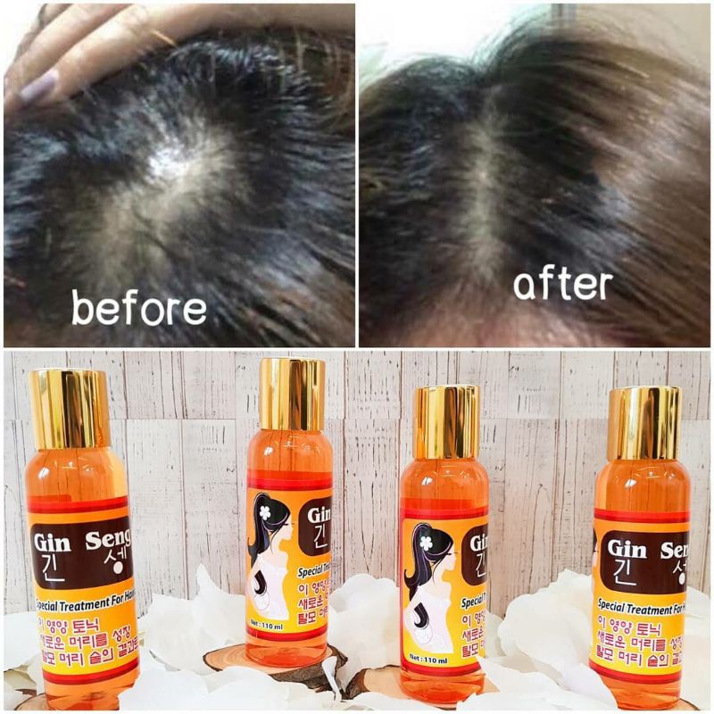 Hair Tonic Red Ginseng Korea Penumbuh Rambut