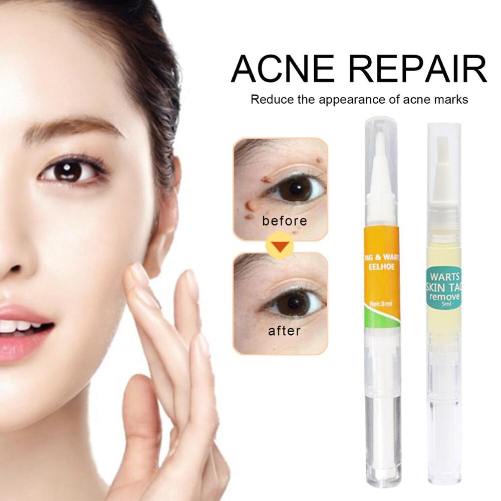 [100% Asli] Krim Obat Penghilang Kutil Badan Krim Penghilang Tanda Kulit Tahi Lalat