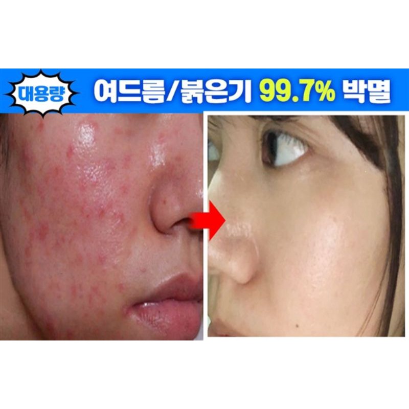 Cica &amp; Artemisia l Whitening Cream FULL SIZE 100GRAM