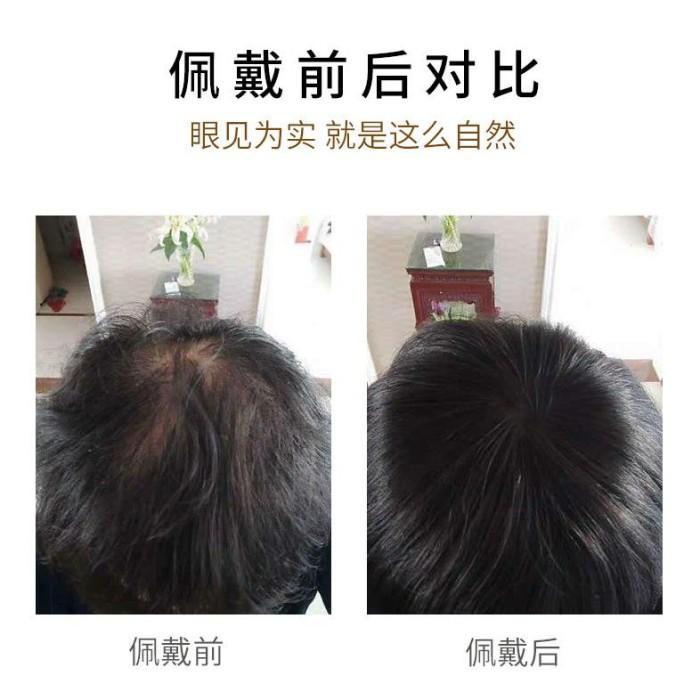 Wig Potongan Wig Rambut Atas Ulang Potongan Wanita Tipis Atas Rambut