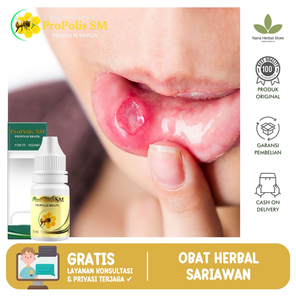 Obat Sariawan Mulut, Obat Sariawan Di Bibir, Obat Sariawan Di Lidah, Obat Sariawan Panas Dalam, Obat