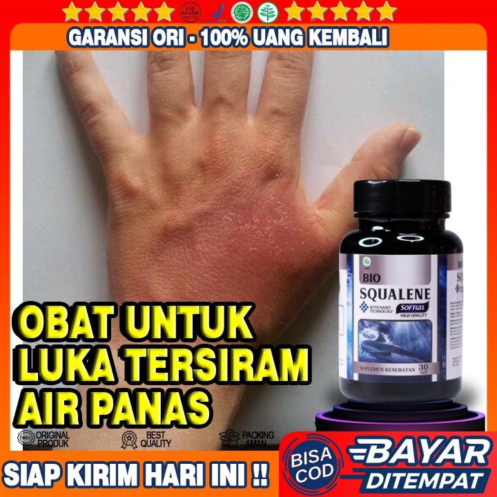 Obat Luka Tersiram Air Panas - Obat Kulit Kena Minyak Panas - Obat Infeksi Kulit Terkena Knalpot - O