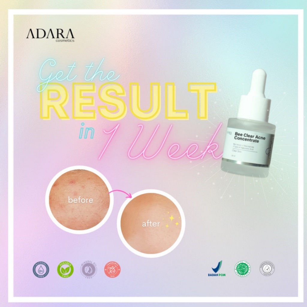 [ FREE GIFT ] ADARA Bee Clear Acne Reguler &amp; Extra Formula | Acne Concentrate Serum