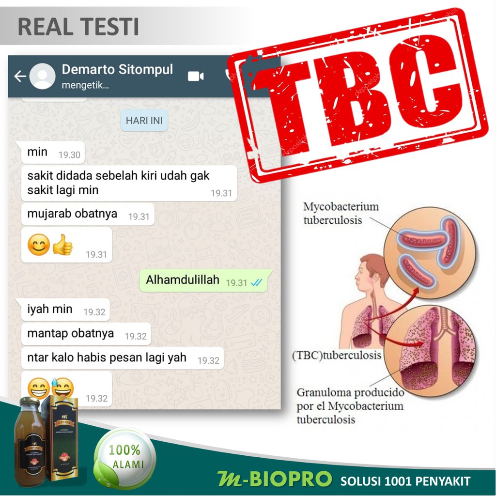 TERBUKTI MANJUR  M BIOPRO Obat Batuk TBC | M BIO PRO Obat TB Kelenjar I MBIOPRO Obat TBC Kelenjar