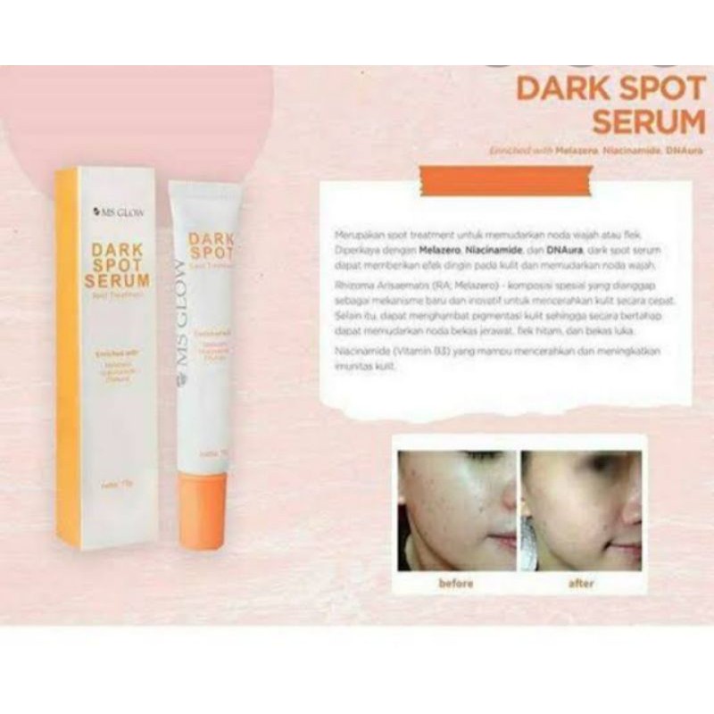 

Dark Spot