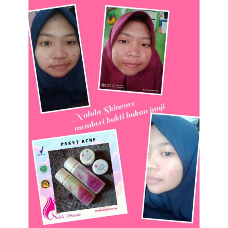 Nahda SKINCARE Eceran Aman untuk busui dan ibu hamil