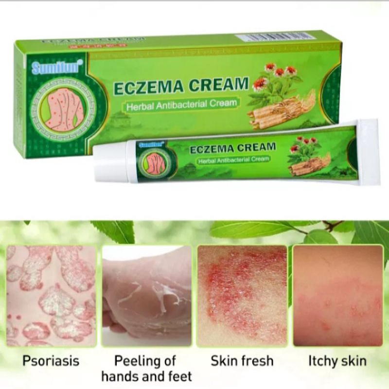 Eczema Cream Herbal Antibacterial salep exzim