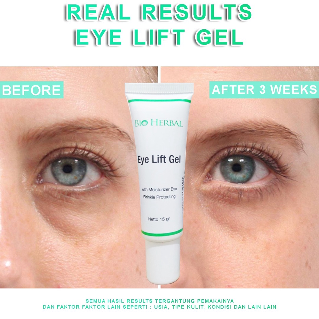 Bio Herbal Eye lift Gel - kpw-251