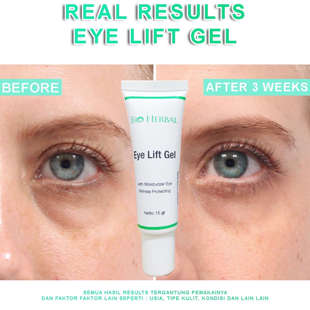 Bio Herbal Eye lift Gel - kpw-251