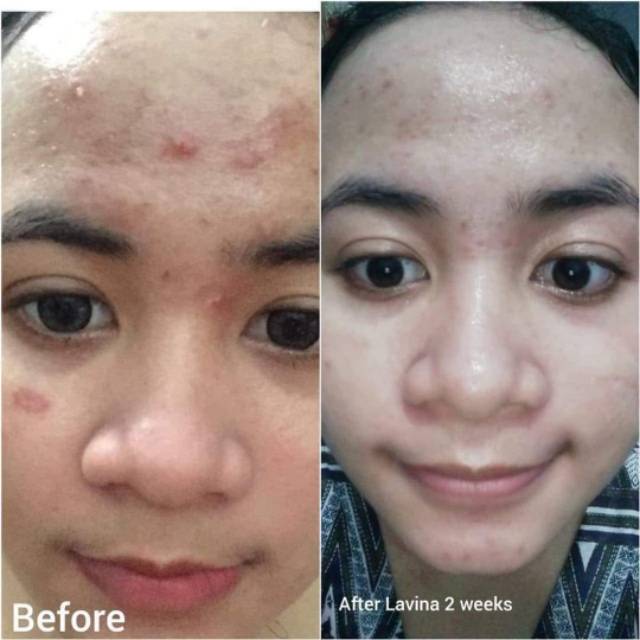 Lavina skincare