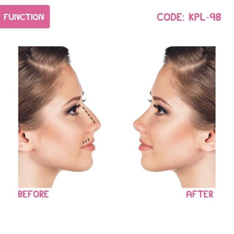 Nose Up Clipper Alat Pemancung Hidung Klip Silicon Alami