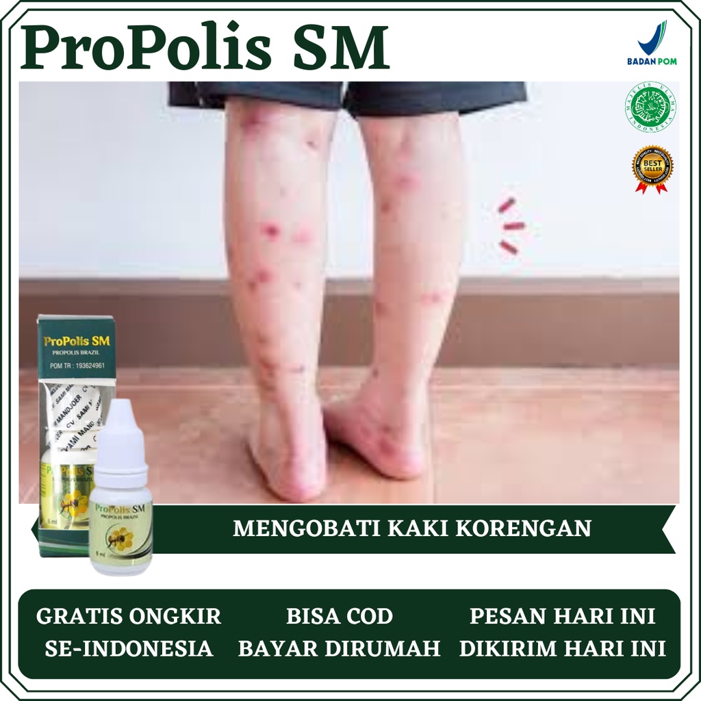 Obat Kaki Koreng, Obat Koreng Gatal, Obat Koreng Selangkangan, Obat Koreng Bernanah, Obat Koreng