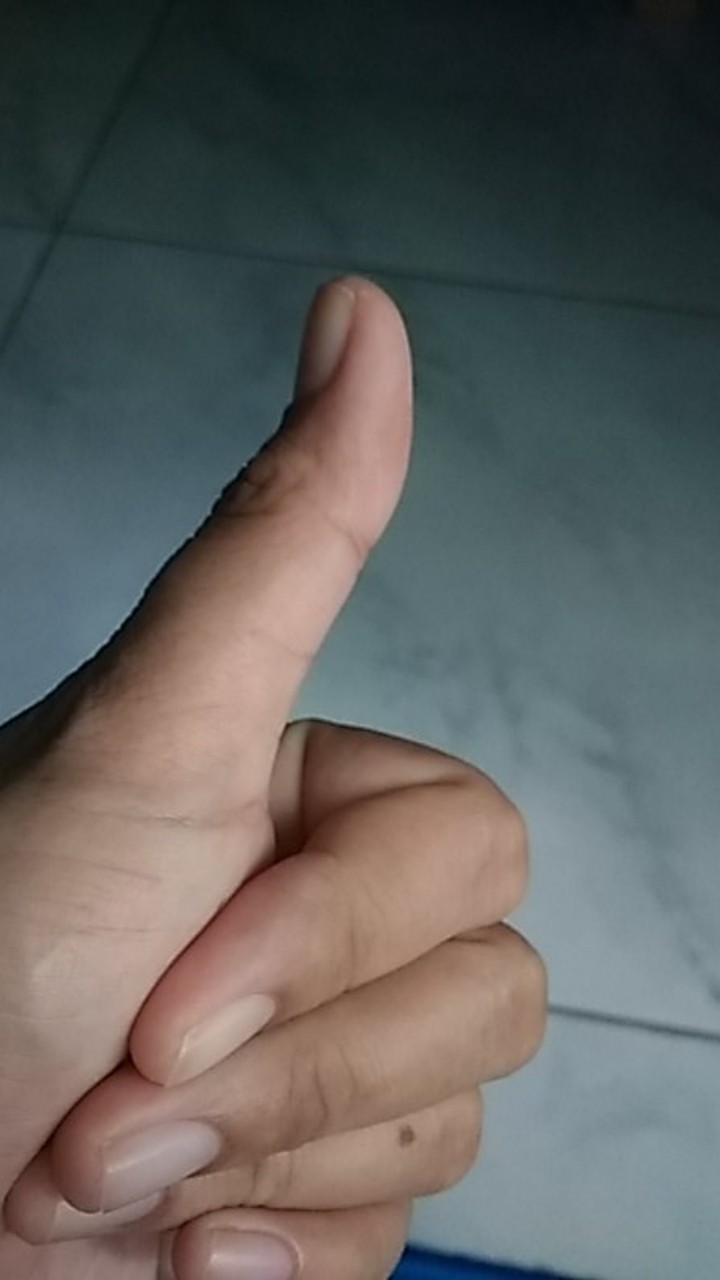 Medisoft Cotton Ball / Kapas Bulat Biru ( 1pack )